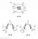 Fig. 07 - Removable and adjustable abutment devices and methods of operation thereof