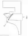 Fig. 06 - System and method for registering implant orientation directly from a dental impression