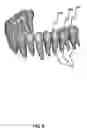 Fig. 09 - System and method for registering implant orientation directly from a dental impression