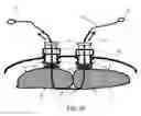 Fig. 11 - System and methods for closing a fascial opening