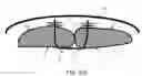 Fig. 12 - System and methods for closing a fascial opening