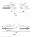 Fig. 04 - EMBOLIC PROTECTION DEVICE