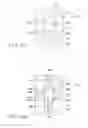 Fig. 13 - SURGICAL PROCEDURE OF KNEE JOINT