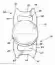 Fig. 01 - Aspherical multifocal intraocular lens