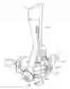 Fig. 01 - Prosthetic mitral valve holders