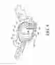 Fig. 10 - Prosthetic mitral valve holders