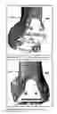 Fig. 09 - A TOOL FOR CUSTOM-MADE INSTRUMENTS AND IMPLANT FOR ARTIFICIAL KNEE JOINT OF DOGS