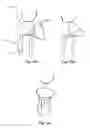 Fig. 12 - Surface replacement implant for the distal humerus