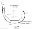 Fig. 07 - PROSTHESIS AND METHOD FOR USING PROSTHESIS TO FACILITATE DEEP KNEE FLEXION