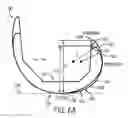 Fig. 09 - PROSTHESIS AND METHOD FOR USING PROSTHESIS TO FACILITATE DEEP KNEE FLEXION
