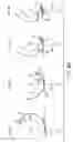 Fig. 12 - PROSTHESIS AND METHOD FOR USING PROSTHESIS TO FACILITATE DEEP KNEE FLEXION