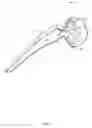 Fig. 02 - Device for sensing implant location and impingement