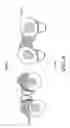 Fig. 09 - Myoelectric prosthesis and method