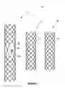 Fig. 02 - STENT AND STENT SET