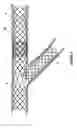Fig. 06 - STENT AND STENT SET