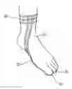 Fig. 01 - THERAPY SOCK