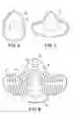 Fig. 03 - Panel attachment and circumference adjustment systems for an orthopedic device
