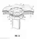 Fig. 08 - Apparatus and associated methodologies for creating a stoma