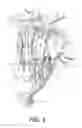 Fig. 03 - NASOLACRIMAL IMPLANTS AND RELATED METHODS FOR TEAR STIMULATION
