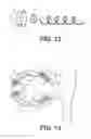 Fig. 09 - NASOLACRIMAL IMPLANTS AND RELATED METHODS FOR TEAR STIMULATION