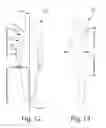 Fig. 10 - Dynamic tensioning orthosis and related method of use