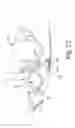 Fig. 19 - Dynamic tensioning orthosis and related method of use