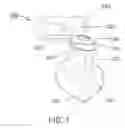 Fig. 02 - Finger vibrator
