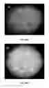 Fig. 32 - Modulators of prostate-specific G-protein receptor (PSGR/OR51E2) and methods of using same