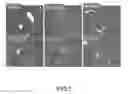 Fig. 02 - Methods and compositions for preventing or treating fatty liver, protecting liver function or ameliorating liver diseases caused by fatty liver or other associated disorders