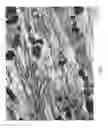 Fig. 02 - SELECTIVE ABLATION OF PAIN-SENSING NEURONS BY ADMINISTRATION OF A VANILLOID RECEPTOR AGONIST