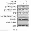 Fig. 08 - Targeting Metabolic Vulnerability in Triple-Negative Breast Cancer