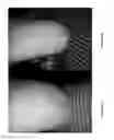 Fig. 02 - Composition and method for treating skin conditions