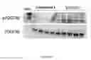 Fig. 06 - Combination therapy for treating pulmonary hypertension