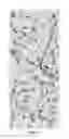 Fig. 06 - Methods of treating eye diseases associated with inflammation and vascular proliferation