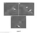 Fig. 08 - Methods of treating eye diseases associated with inflammation and vascular proliferation