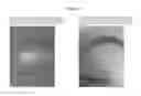 Fig. 06 - COMPOSITIONS AND METHODS FOR TREATING SKIN CONDITIONS
