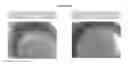 Fig. 09 - COMPOSITIONS AND METHODS FOR TREATING SKIN CONDITIONS