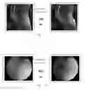 Fig. 08 - COMPOSITION FOR TREATING ARTICULAR CARTILAGE DEFECTS