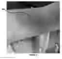 Fig. 07 - METHOD OF TREATING PATIENTS WITH NON-IgE MEDIATED HYPERSENSITIVITIES TO ENVIRONMENTAL ALLERGENS