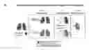 Fig. 01 - PULMONARY INTRAVASCULAR NON-CLASSICAL MONOCYTES MEDIATE LUNG TRANSPLANT ISCHEMIA-REPERFUSION INJURY