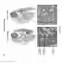 Fig. 03 - PULMONARY INTRAVASCULAR NON-CLASSICAL MONOCYTES MEDIATE LUNG TRANSPLANT ISCHEMIA-REPERFUSION INJURY