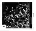Fig. 15 - PULMONARY INTRAVASCULAR NON-CLASSICAL MONOCYTES MEDIATE LUNG TRANSPLANT ISCHEMIA-REPERFUSION INJURY