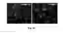 Fig. 08 - MESENCHYMAL STEM CELLS-HYDROGEL-BIODEGRADABLE OR MESENCHYMAL STEM CELLS-HYDROGEL-NONDEGRADABLE SUPPORT COMPOSITION FOR ALLEVIATING OR IMPROVING EPIDERMOLYSIS BULLOSA