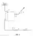 Fig. 07 - Implantable infusion pumping catheter