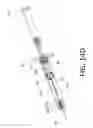 Fig. 37 - System and method for safety syringe