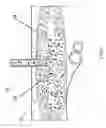 Fig. 06 - Intramarrow injection/infusion and aspiration needle and method