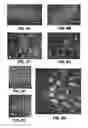 Fig. 09 - Spinal subpial gene delivery system