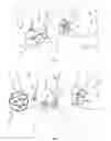 Fig. 04 - External pulse generator device and associated methods for trial nerve stimulation