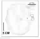 Fig. 01 - Treating degenerative dementia with low intensity focused ultrasound pulsation (LIFUP) device