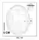 Fig. 05 - Treating degenerative dementia with low intensity focused ultrasound pulsation (LIFUP) device